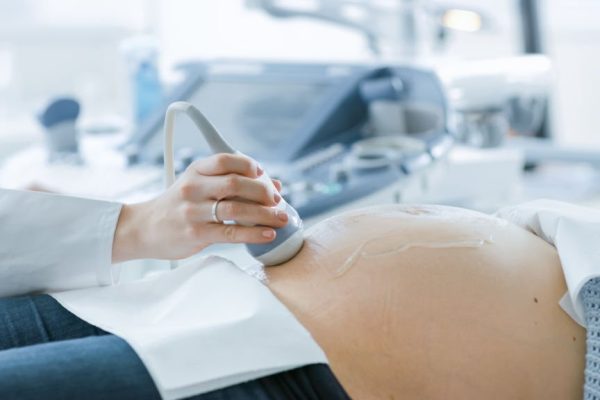 pregled-ginekologija-vrsac-vršac In the Hospital, Close-up Shot of the Doctor Doing Ultrasound / Sonogram Scan to a Pregnant Woman. Obstetrician Moving Transducer on the Belly of the Future Mother.